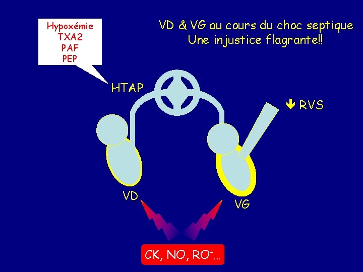 VD & VG au cours du choc septique Une injustice flagrante!! Hypoxémie TXA 2