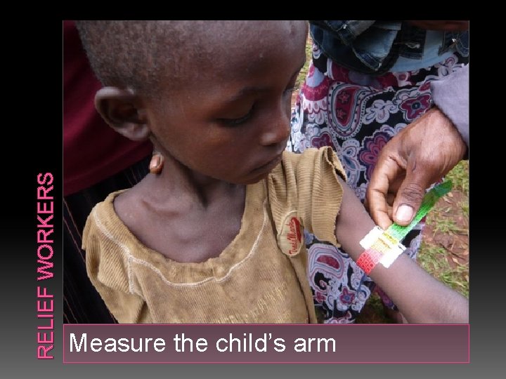 RELIEF WORKERS Measure the child’s arm 