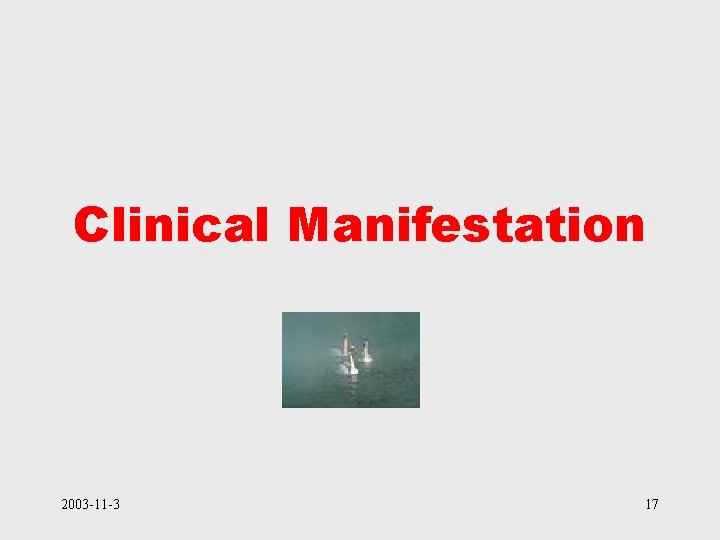 Clinical Manifestation 2003 -11 -3 17 