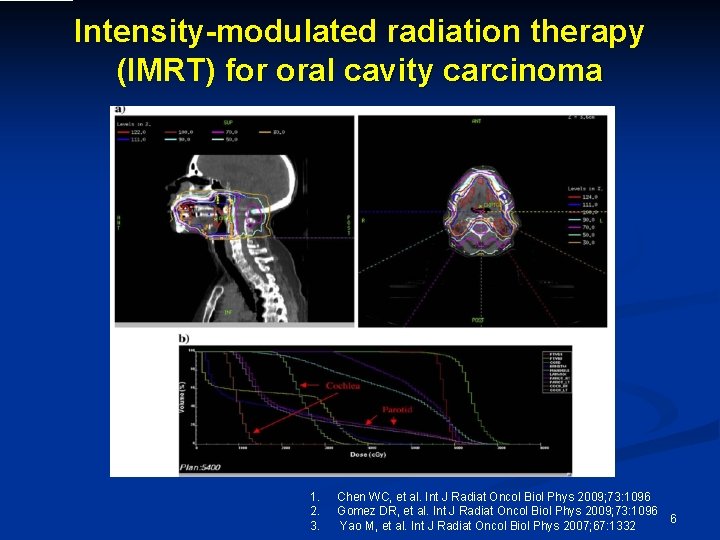 Intensity-modulated radiation therapy (IMRT) for oral cavity carcinoma 1. 2. 3. Chen WC, et