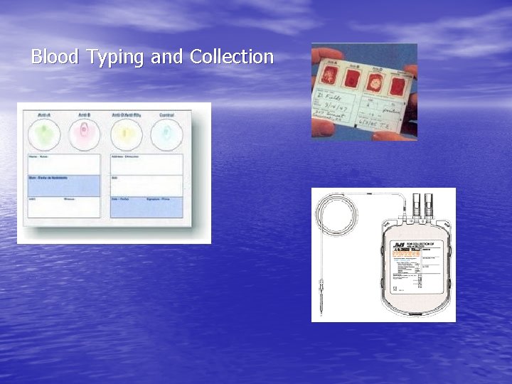 Blood Typing and Collection Blood Typing and Collection