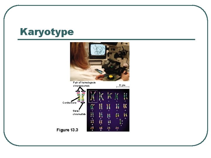 Karyotype Pair of homologous chromosomes Centromere Sister chromatids Figure 13. 3 5 µm 