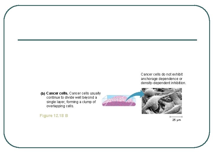 Cancer cells do not exhibit anchorage dependence or density-dependent inhibition. (b) Cancer cells usually