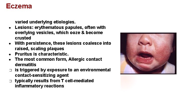 Eczema ● ● ● � � A clinical term for a number of conditions