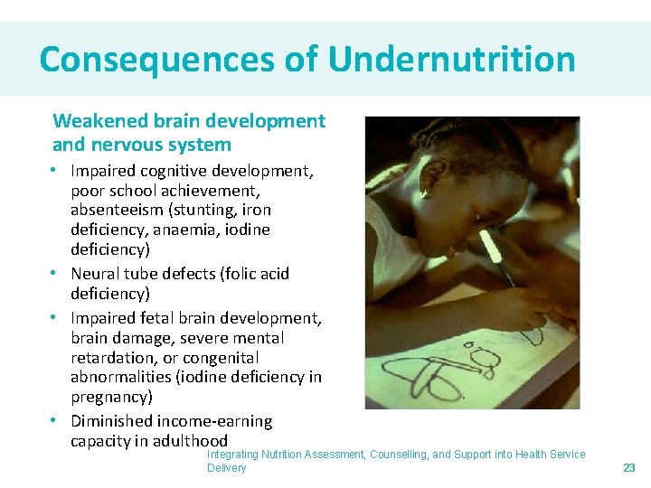 Consequences of Undernutrition Weakened brain development and nervous system • Impaired cognitive development, poor