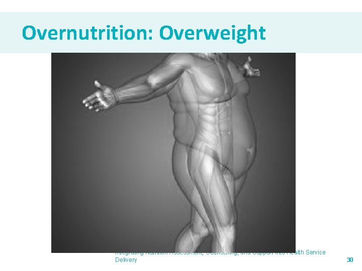 Overnutrition: Overweight Integrating Nutrition Assessment, Counselling, and Support into Health Service Delivery 30 