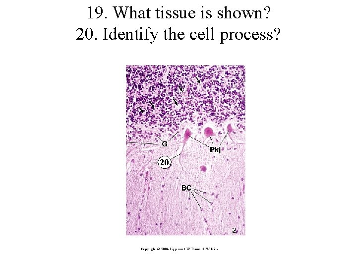19. What tissue is shown? 20. Identify the cell process? 20. 