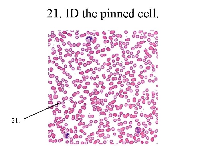 21. ID the pinned cell. 21. 