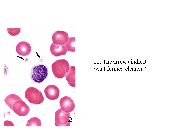 22. The arrows indicate what formed element? 