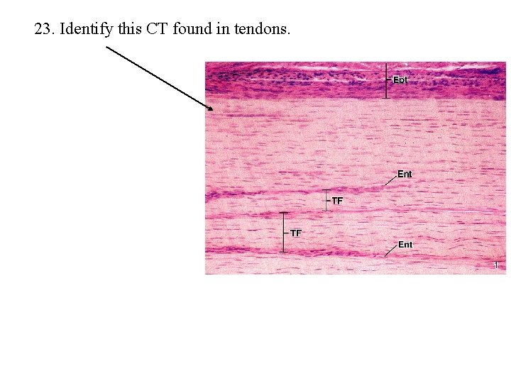 23. Identify this CT found in tendons. 