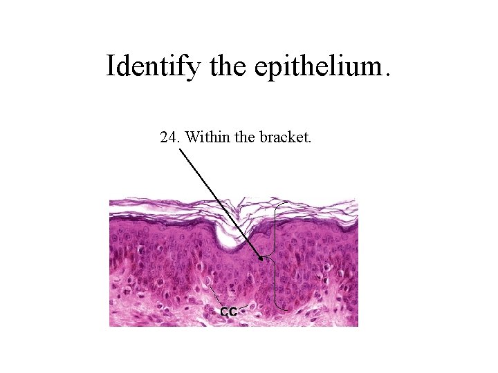 Identify the epithelium. 24. Within the bracket. 