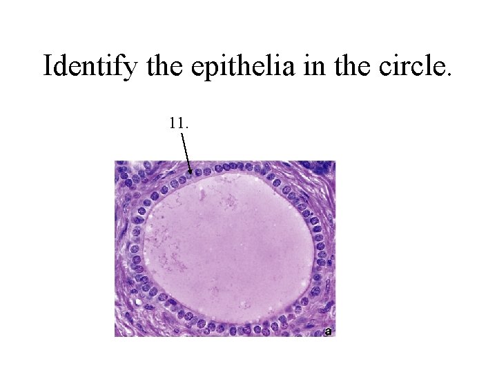 Identify the epithelia in the circle. 11. 