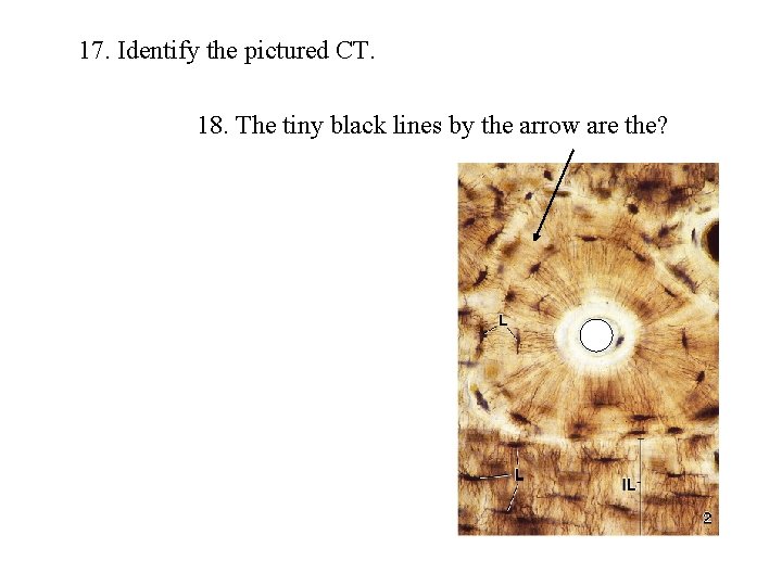 17. Identify the pictured CT. 18. The tiny black lines by the arrow are