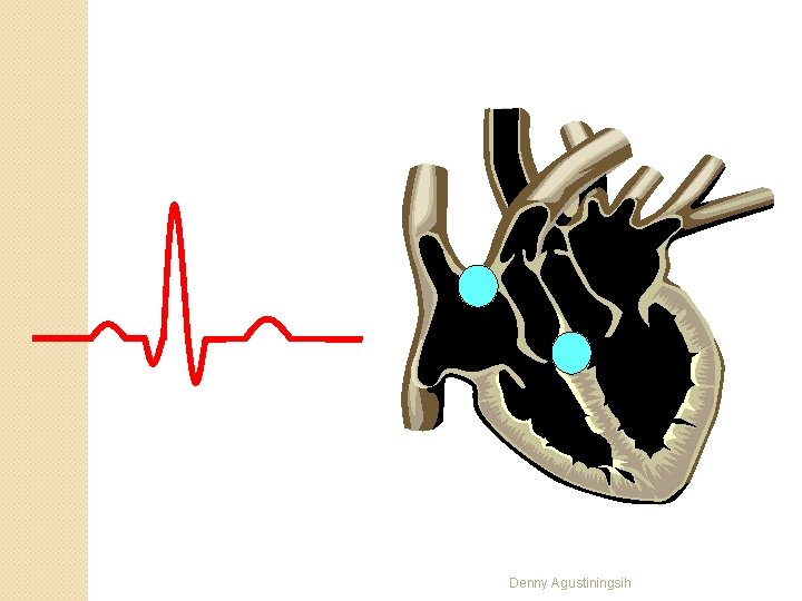 R T P Q S Denny Agustiningsih 