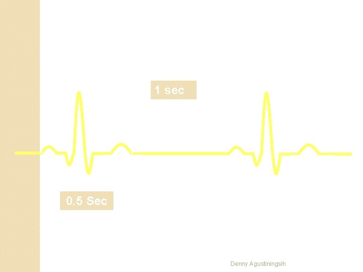 R 1 sec T P Q S 0. 5 Sec Denny Agustiningsih 