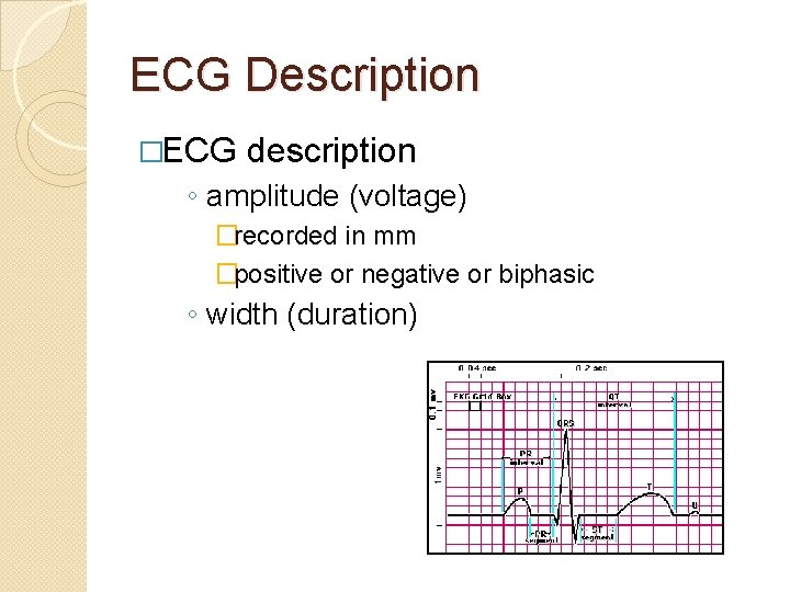 ECG Description �ECG description ◦ amplitude (voltage) �recorded in mm �positive or negative or