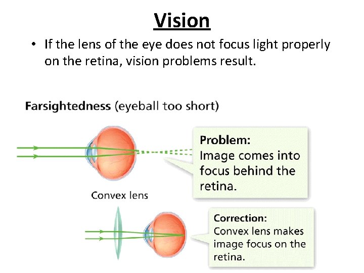 - The Senses Vision • If the lens of the eye does not focus