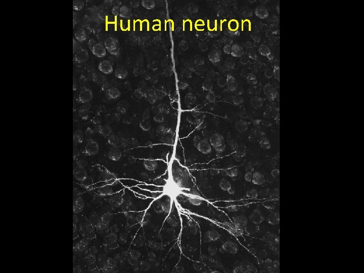 Human neuron 