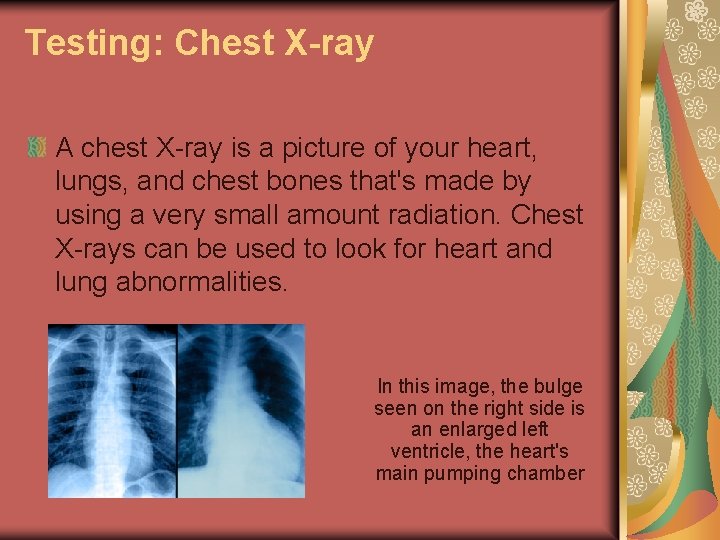 Testing: Chest X-ray A chest X-ray is a picture of your heart, lungs, and