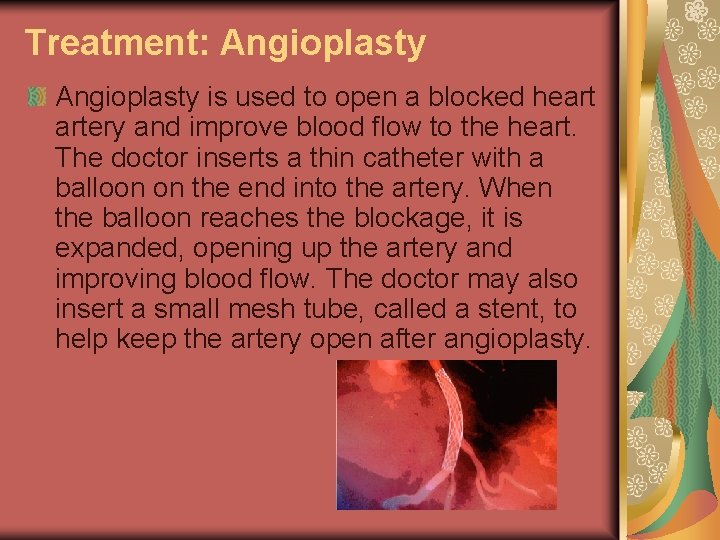Treatment: Angioplasty is used to open a blocked heart artery and improve blood flow