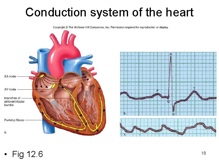 Conduction system of the heart • Fig 12. 6 18 