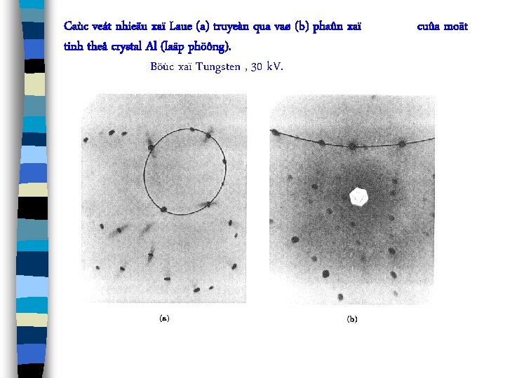 Caùc veát nhieãu xaï Laue (a) truyeàn qua vaø (b) phaûn xaï tinh theå