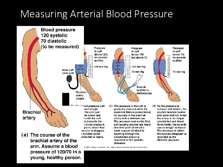 Measuring Arterial Blood Pressure Measuring Arterial Blood Pressure