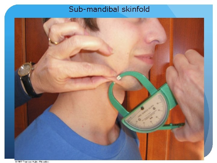 Sub-mandibal skinfold © 2007 Thomson - Wadsworth 