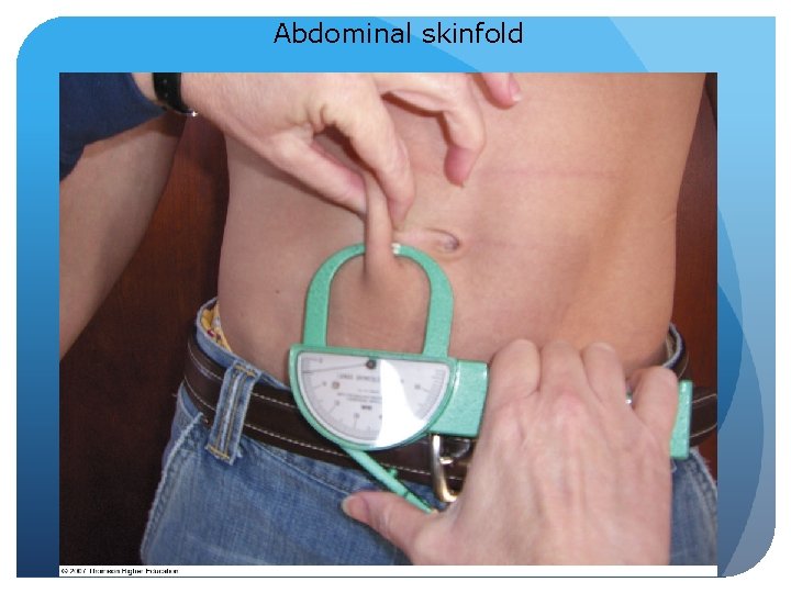 Abdominal skinfold 