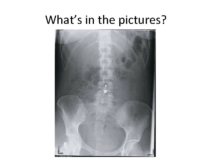 What’s in the pictures? 