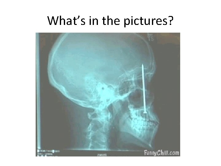What’s in the pictures? 