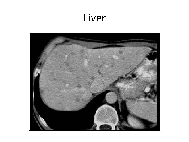 Liver 