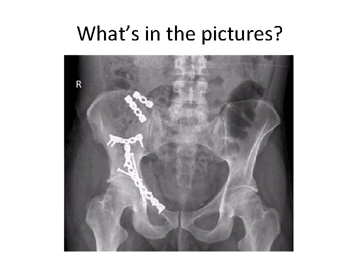 What’s in the pictures? 