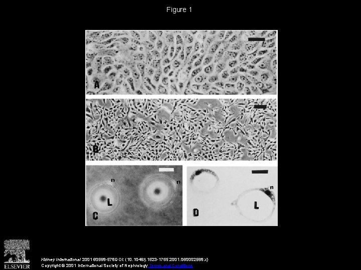Figure 1 Kidney International 2001 60568 -578 DOI: (10. 1046/j. 1523 -1755. 2001. 060002568.