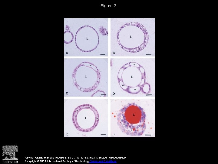 Figure 3 Kidney International 2001 60568 -578 DOI: (10. 1046/j. 1523 -1755. 2001. 060002568.