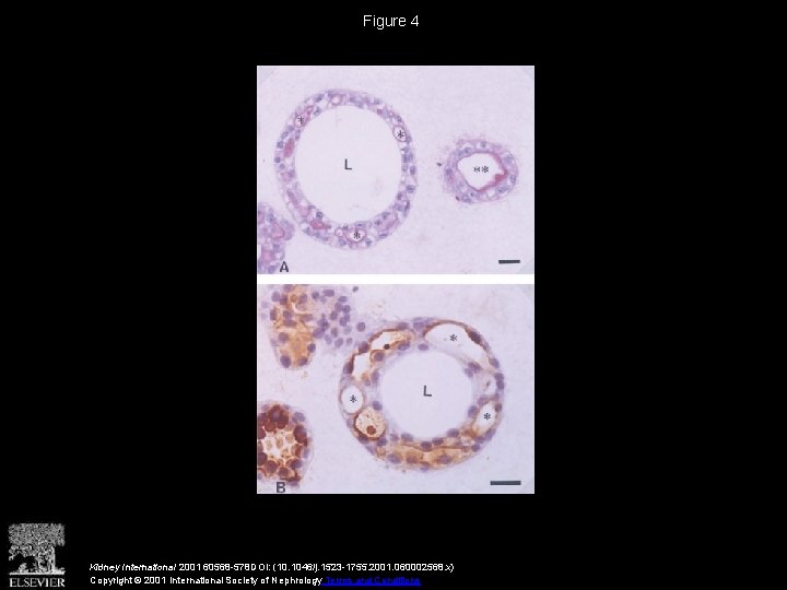 Figure 4 Kidney International 2001 60568 -578 DOI: (10. 1046/j. 1523 -1755. 2001. 060002568.
