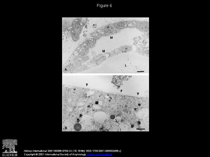 Figure 6 Kidney International 2001 60568 -578 DOI: (10. 1046/j. 1523 -1755. 2001. 060002568.