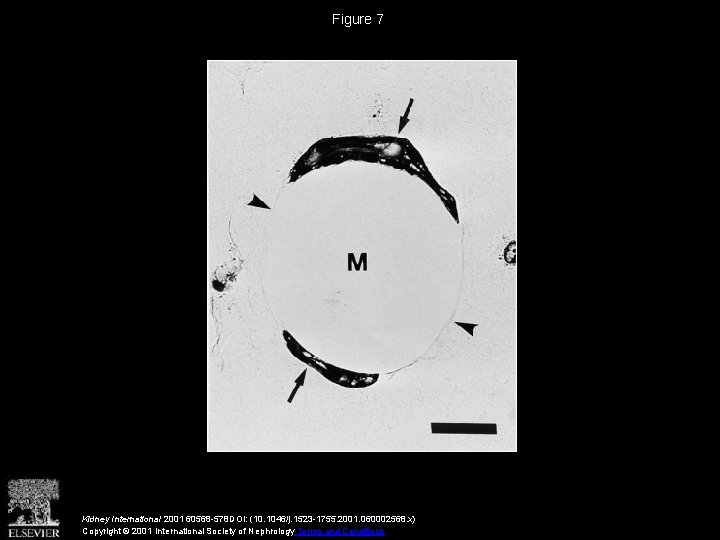 Figure 7 Kidney International 2001 60568 -578 DOI: (10. 1046/j. 1523 -1755. 2001. 060002568.