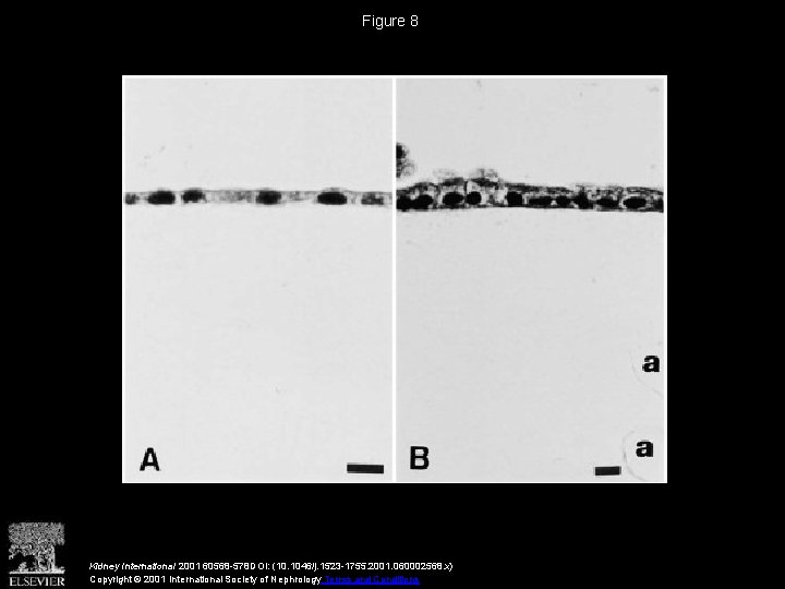Figure 8 Kidney International 2001 60568 -578 DOI: (10. 1046/j. 1523 -1755. 2001. 060002568.