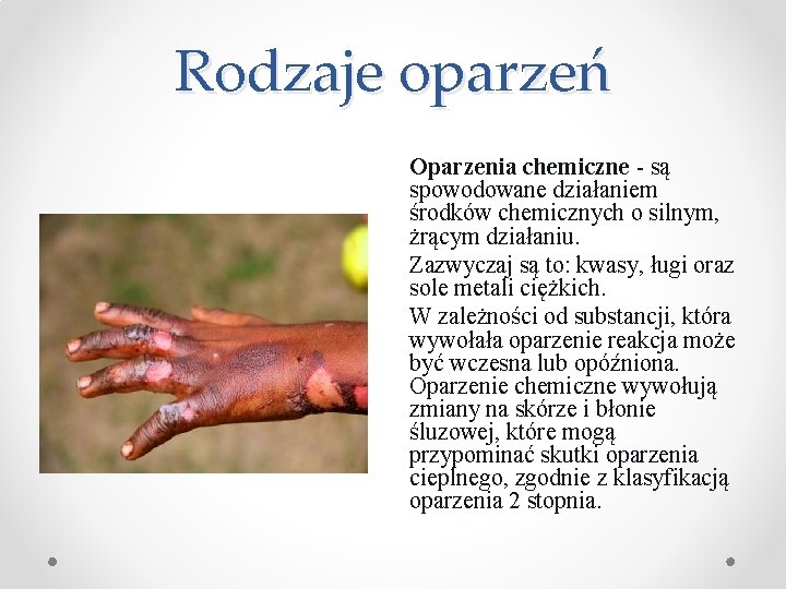 Rodzaje oparzeń Oparzenia chemiczne - są spowodowane działaniem środków chemicznych o silnym, żrącym działaniu.