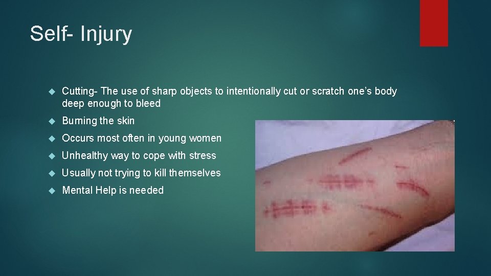 Self- Injury Cutting- The use of sharp objects to intentionally cut or scratch one’s
