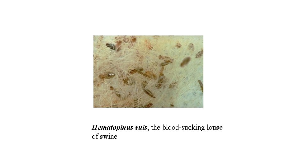 Hematopinus suis, the blood-sucking louse of swine 