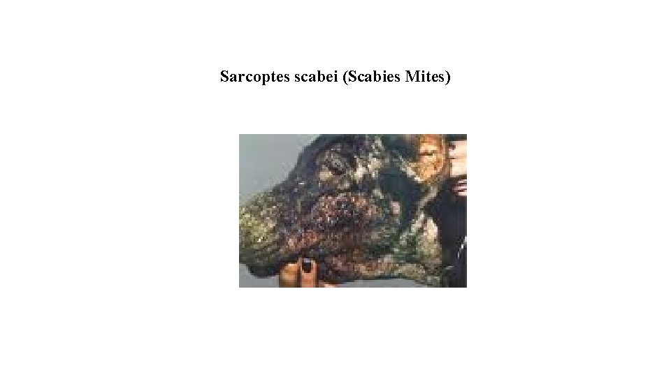 Sarcoptes scabei (Scabies Mites) 