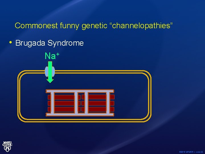 Commonest funny genetic “channelopathies” • Brugada Syndrome Na+ © 2015 MFMER | slide-22 