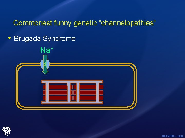 Commonest funny genetic “channelopathies” • Brugada Syndrome Na+ © 2015 MFMER | slide-23 