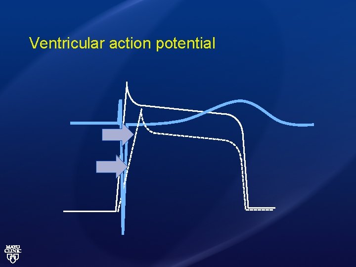 Ventricular action potential 