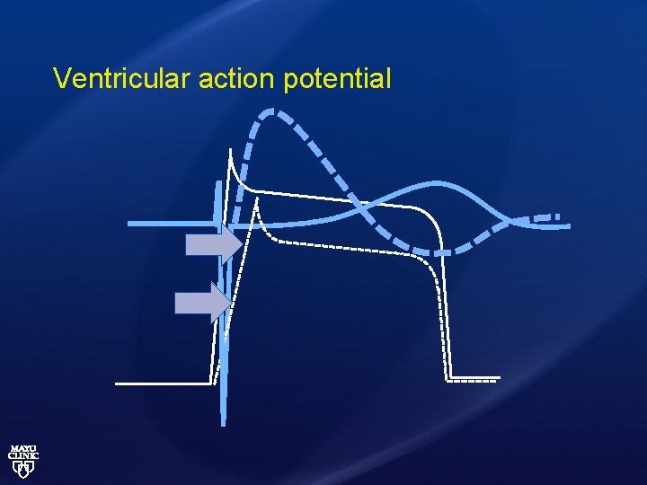 Ventricular action potential 