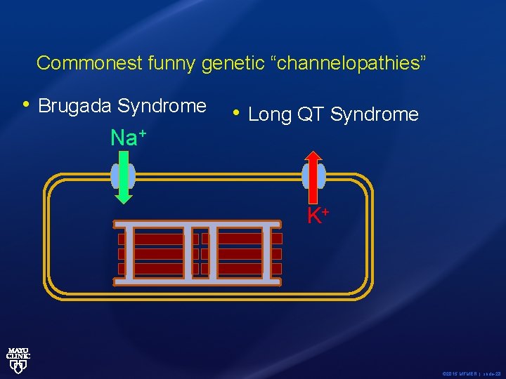 Commonest funny genetic “channelopathies” • Brugada Syndrome Na+ • Long QT Syndrome K+ ©