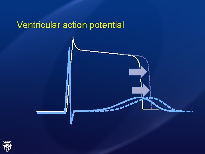 Ventricular action potential 