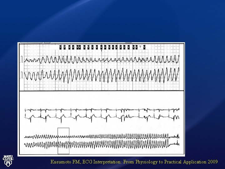 Kusumoto FM, ECG Interpretation: From Physiology to Practical Application 2009 